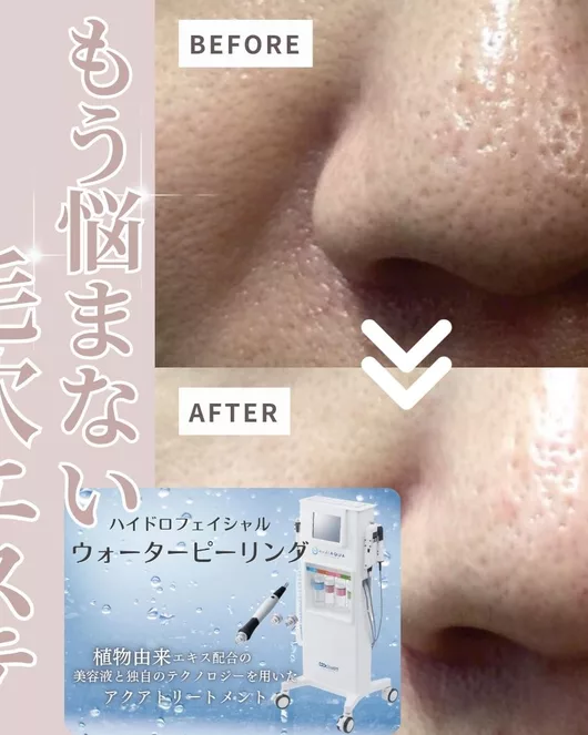 毛穴ケア＆フェイシャルオールハンドトリートメント・美顔矯正　施術時間75分　所要時間120分　女性限定